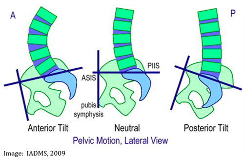 Diagrams of pelivc tilt